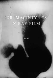 X-Ray Cinematography of Frog's Legs (1896)