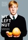My Left Nut (2020–)
